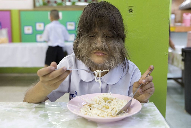 Want More Hair? You Got It | Getty Images Photo by Bronek Kaminski/Barcroft Media